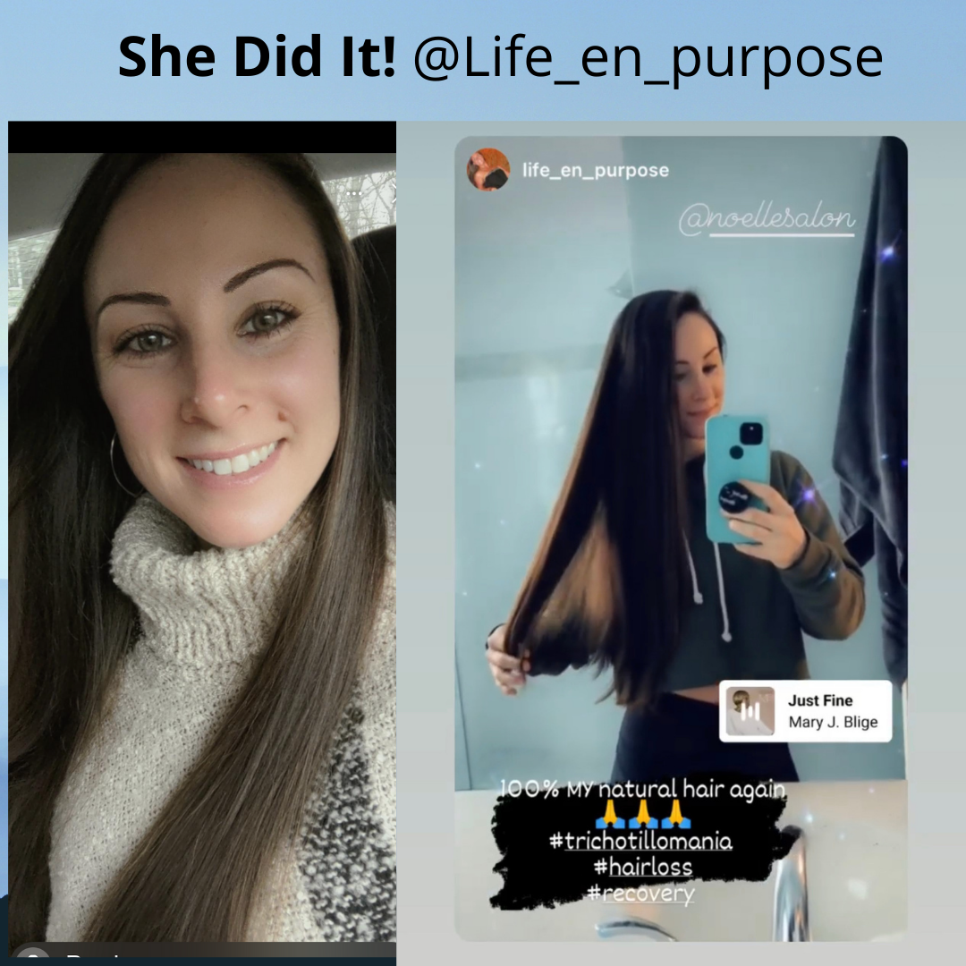 how to stop hair pulling for good