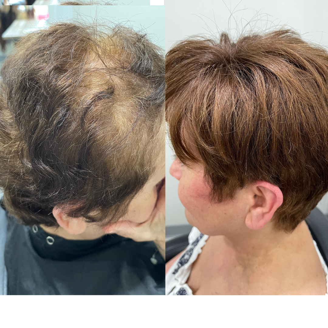 human vs, synthetic wigs and hair toppers