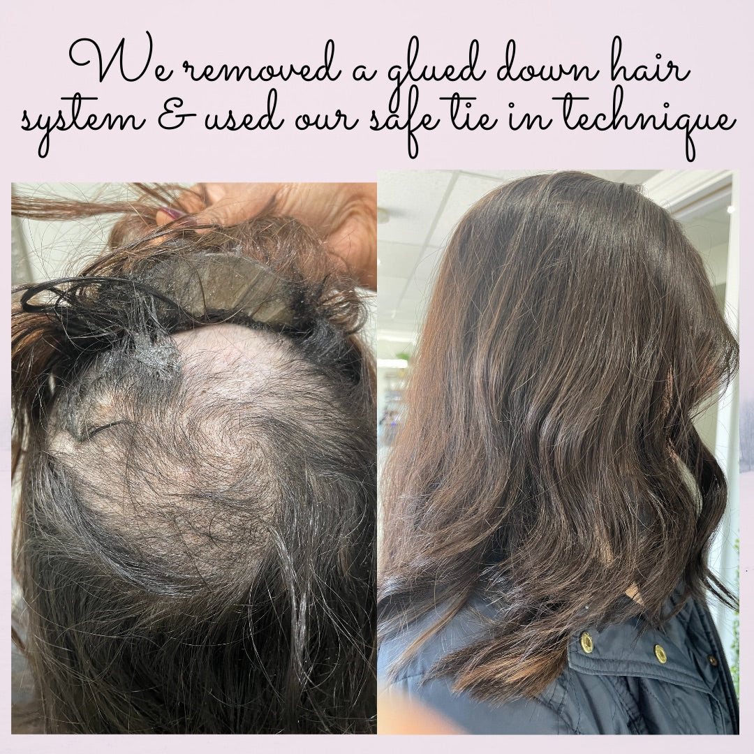 Glue Down Hair System Can Ruin Your Own hair