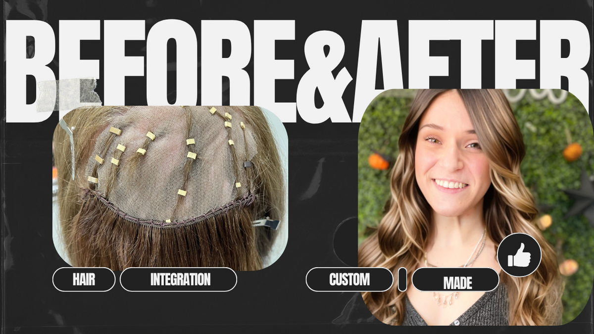 Dermatologist Alopecia Near Me Expert Care for Hair Loss Dermatologist Alopecia Near Me Expert Care for Hair Loss