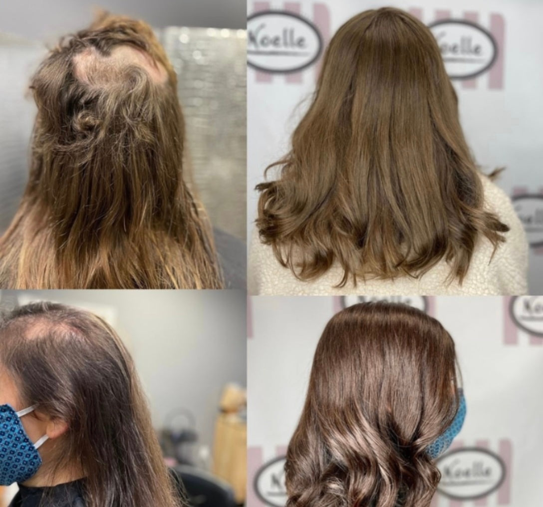 Before and after showing coverage with silk and lace hair toppers.