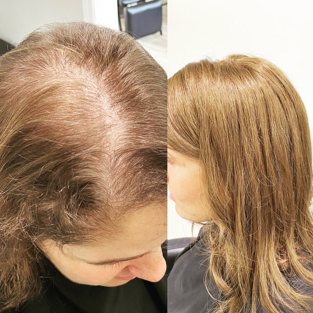 https://noellesalon.com/collections/all/products/free-hair-loss-consultation