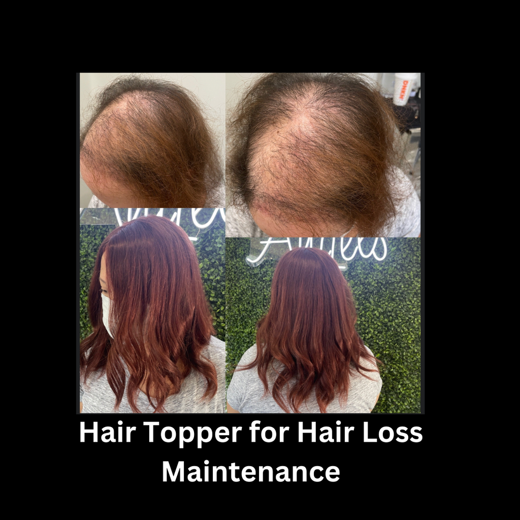 hair topper for hair loss maintenane