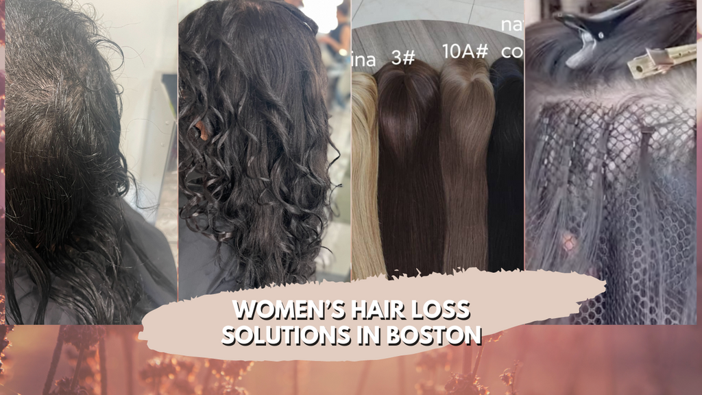 Women's Hair Loss Solutions Boston: Effective Strategies
