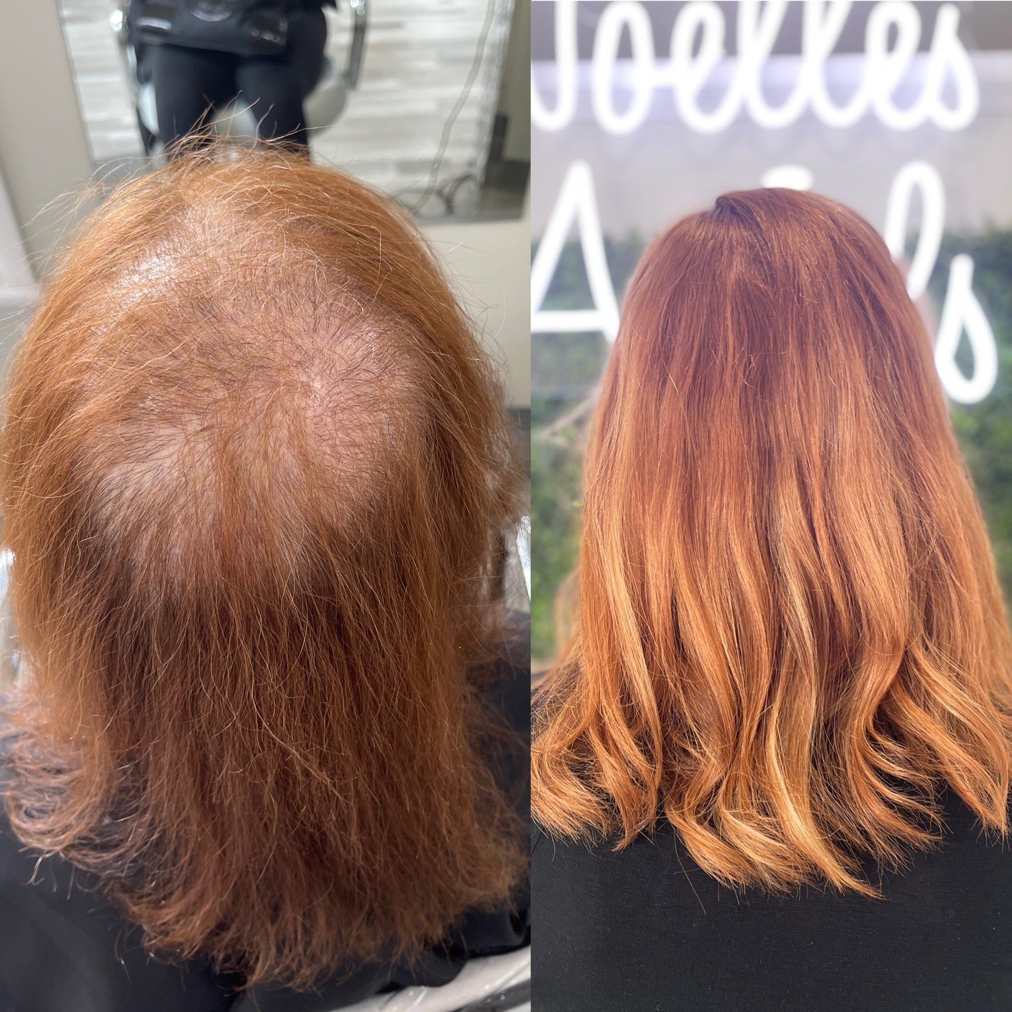 Help for female hair loss