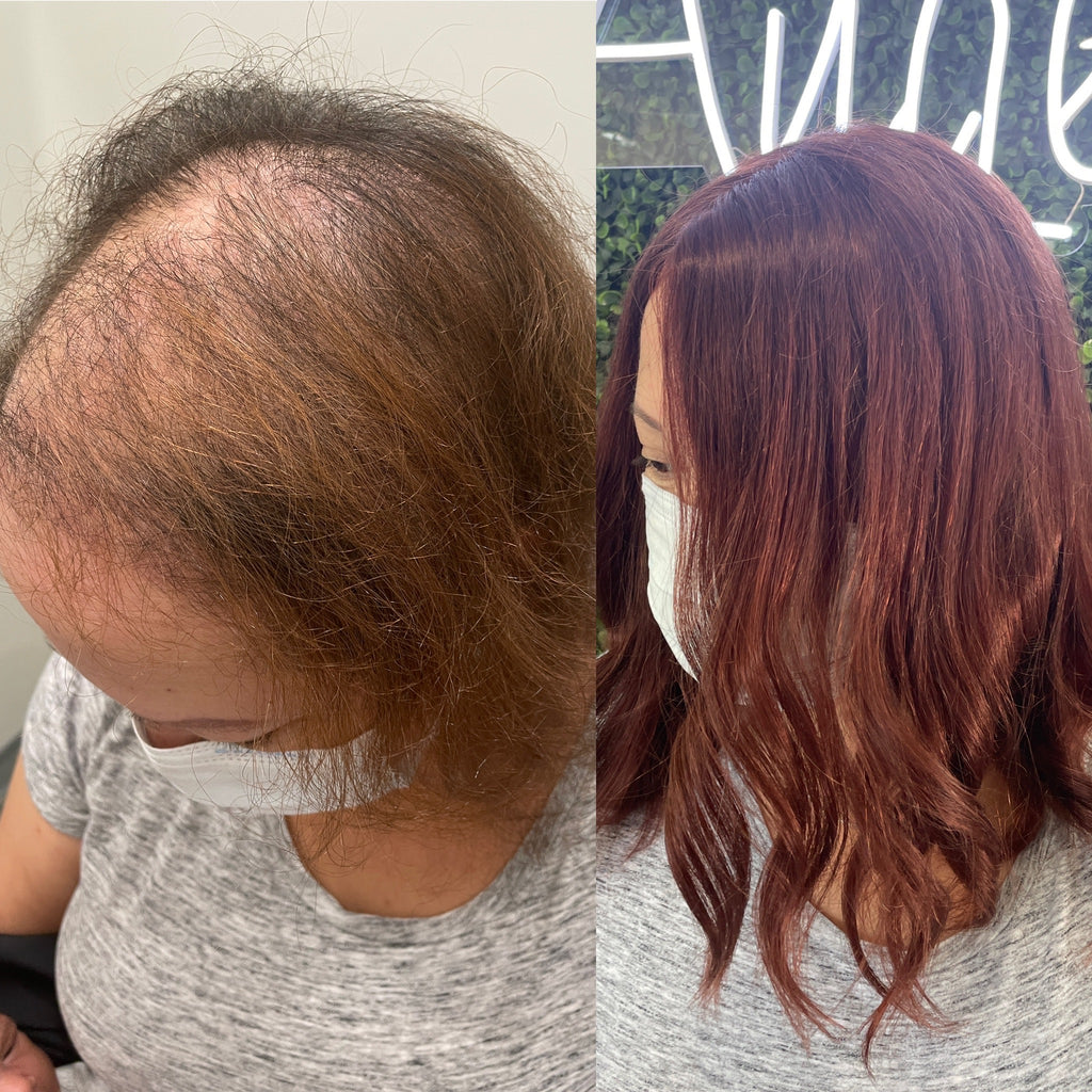 Maintenance With Trichotillomania Clients