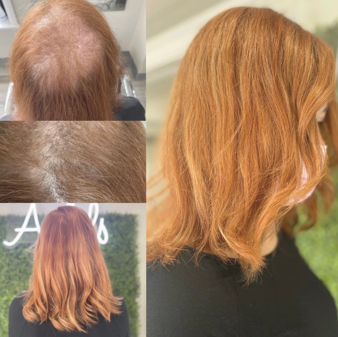 Hair topper before and after results showing natural coverage for thinning hair.