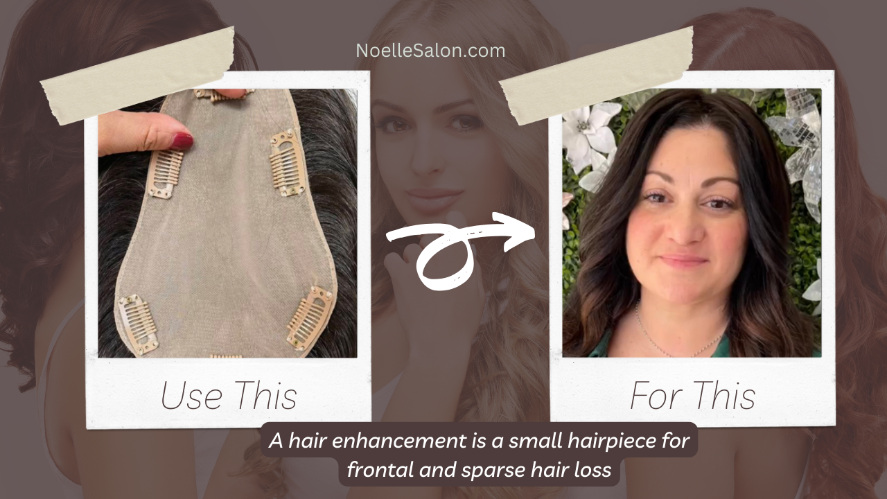 Hair Enhancements for Hair Loss: Boston Solutions