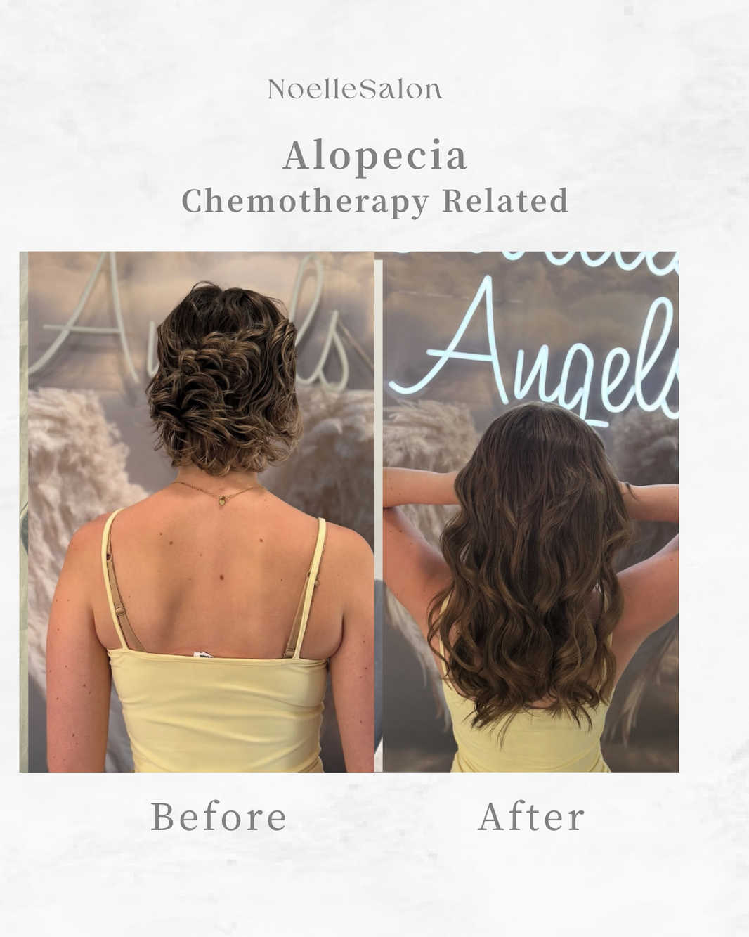 Chemotherapy-related hair loss transformation showing fuller hair and restored confidence after customized hair extensions at Noelle Salon Boston