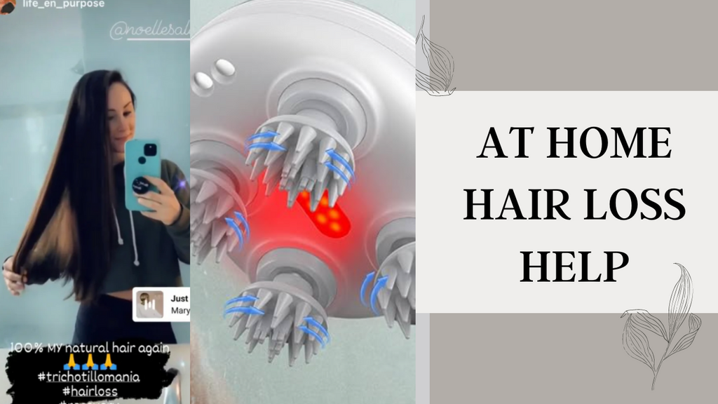 Best At-Home Hair Loss Treatment Solutions Boston