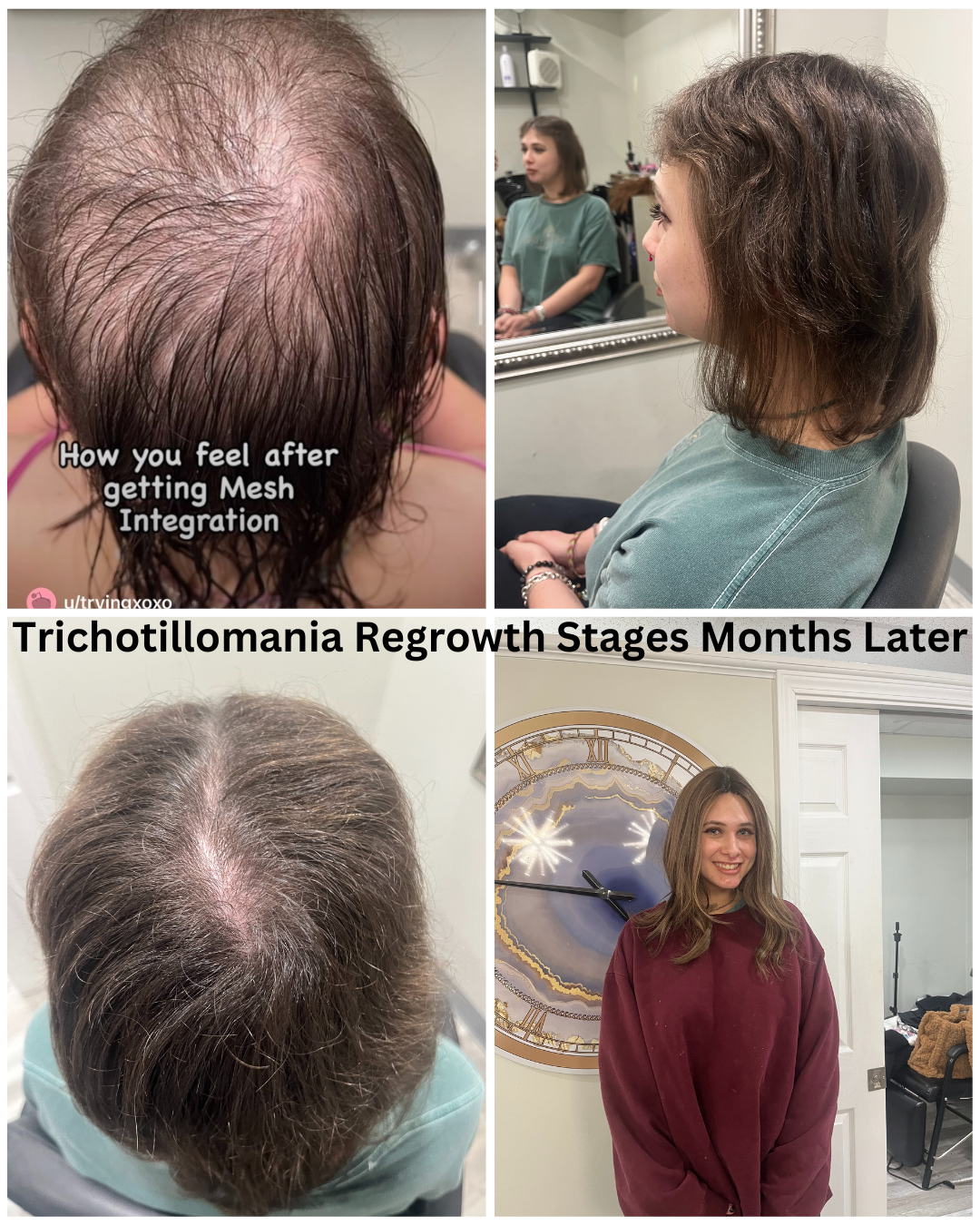 Trichotillomania Specialists at Noelle Salon