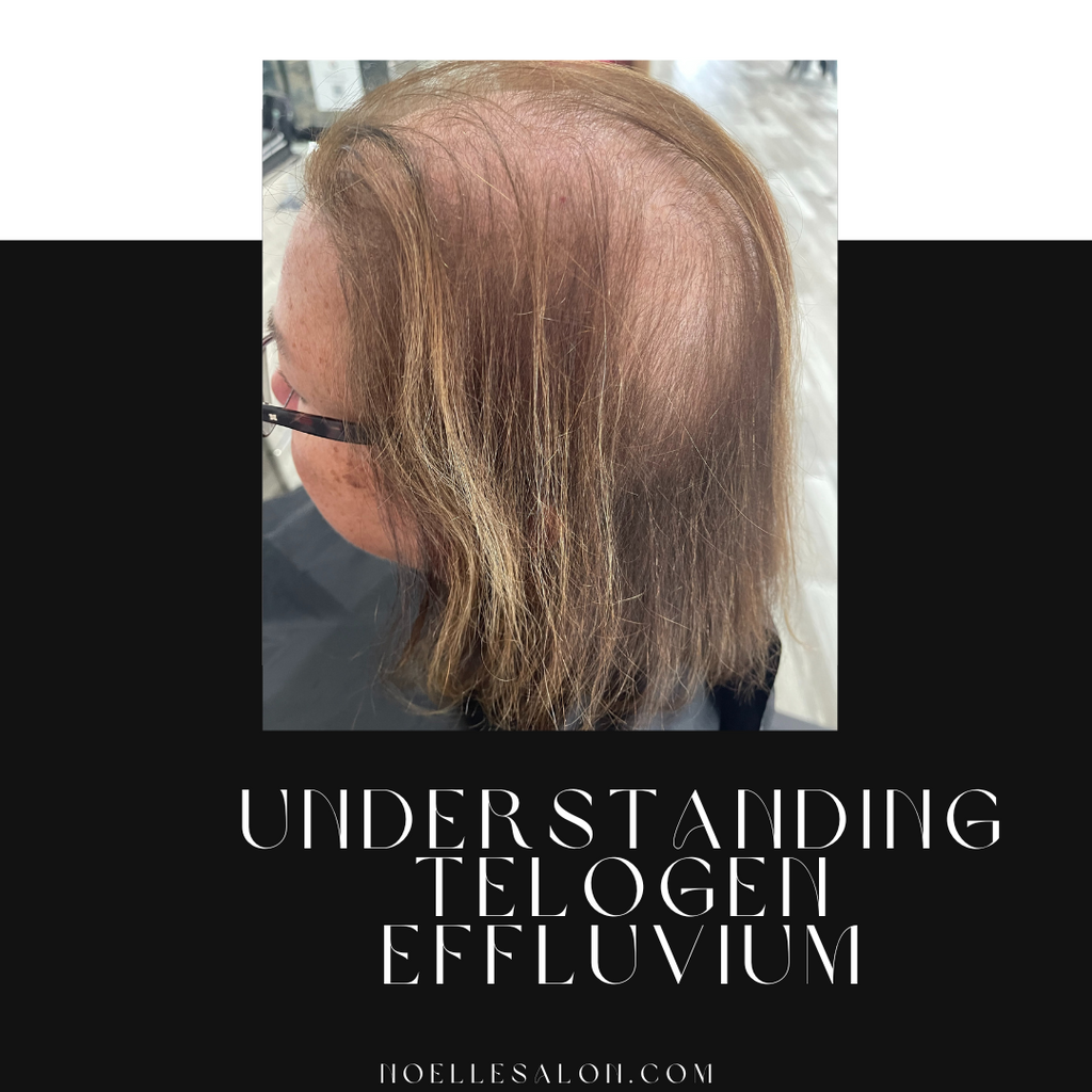 Understanding Telogen Effluvium