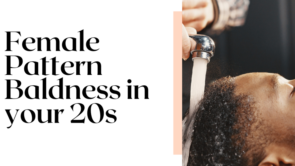 Female Pattern Baldness in 20s: Unveiling the Truth