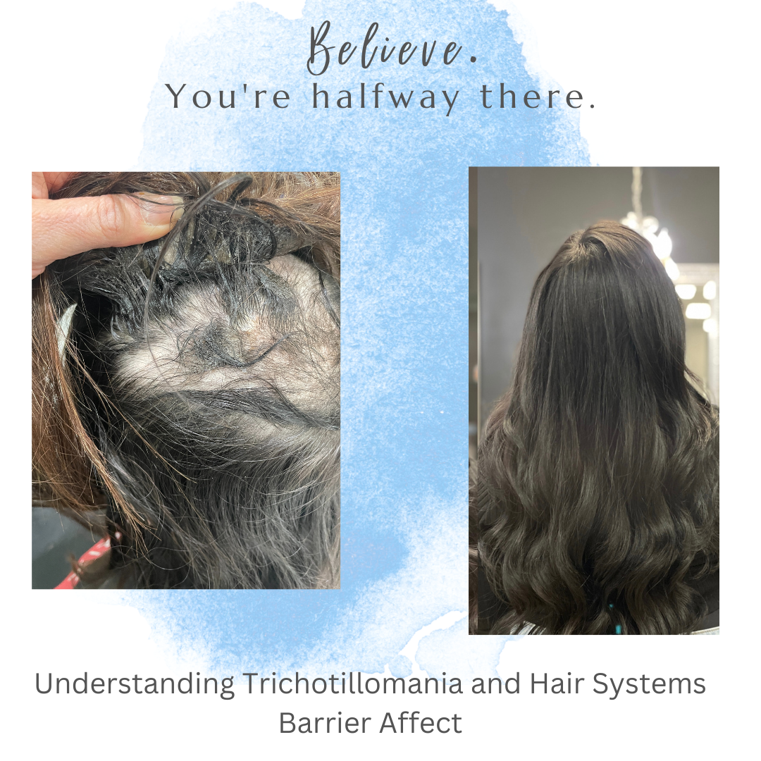 Understanding Trichotillomania How Hair Systems Offer A Solution