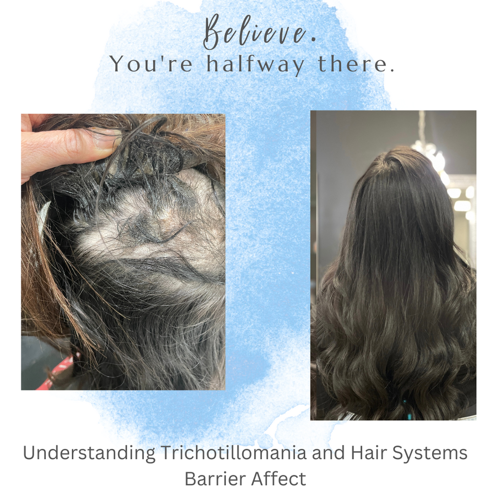 Understanding Trichotillomania How Hair Systems Offer A Solution