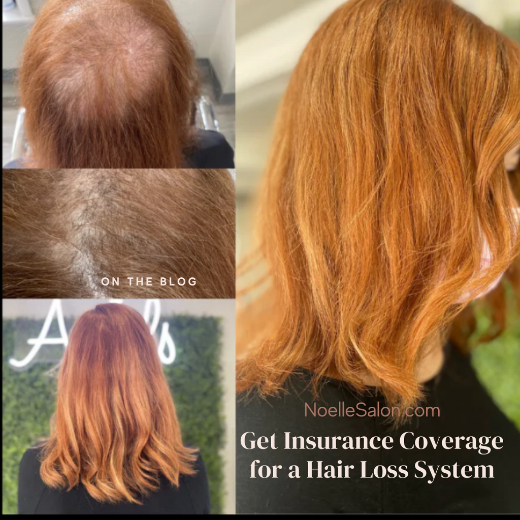 Hair Topper & Hair Loss Insurance: Essential Coverage Guide
