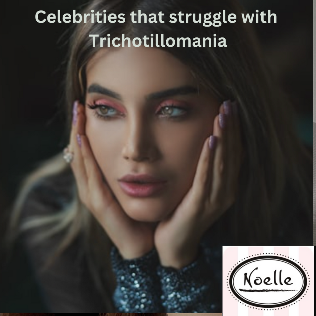 Celebrities that struggle with Trichotillomania
