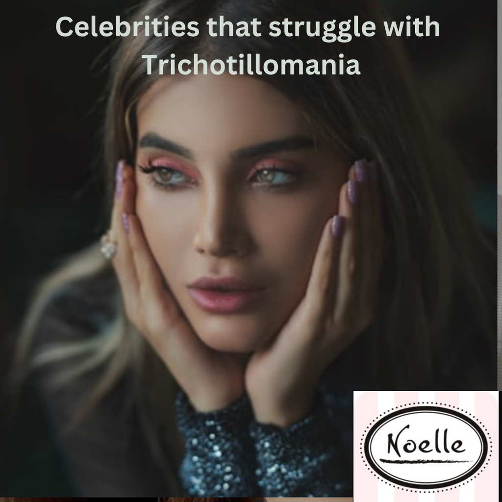 Celebrities with Trichotillomania