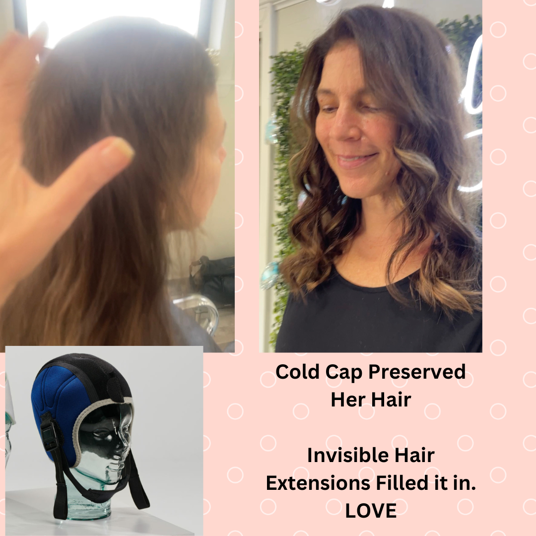 Hair Extension after Scalp Cooling