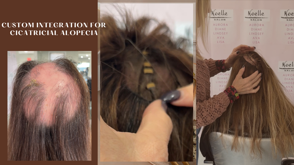 Types of Wig Mesh That GUGU Hair Provides 10 Custom-Made Mesh Integration Wigs for Cicatricial Alopecia – noellesalon