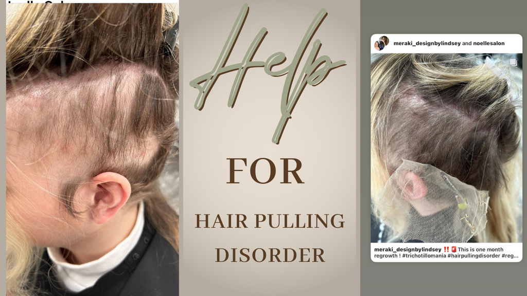 How We Can Help with Hair-Pulling Disorder: Boston