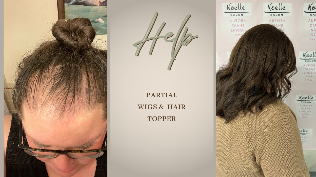 a woman wearing a partial wig