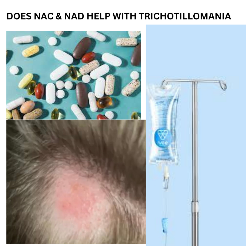 Does NAC and NAD Plus help with trichotillomania?