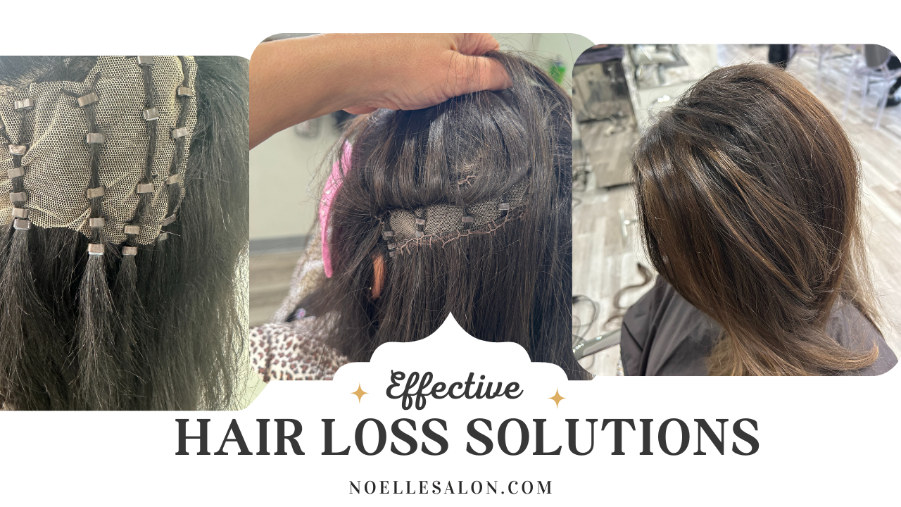 Effective Hair Loss Problem Solutions Boston: Try Now