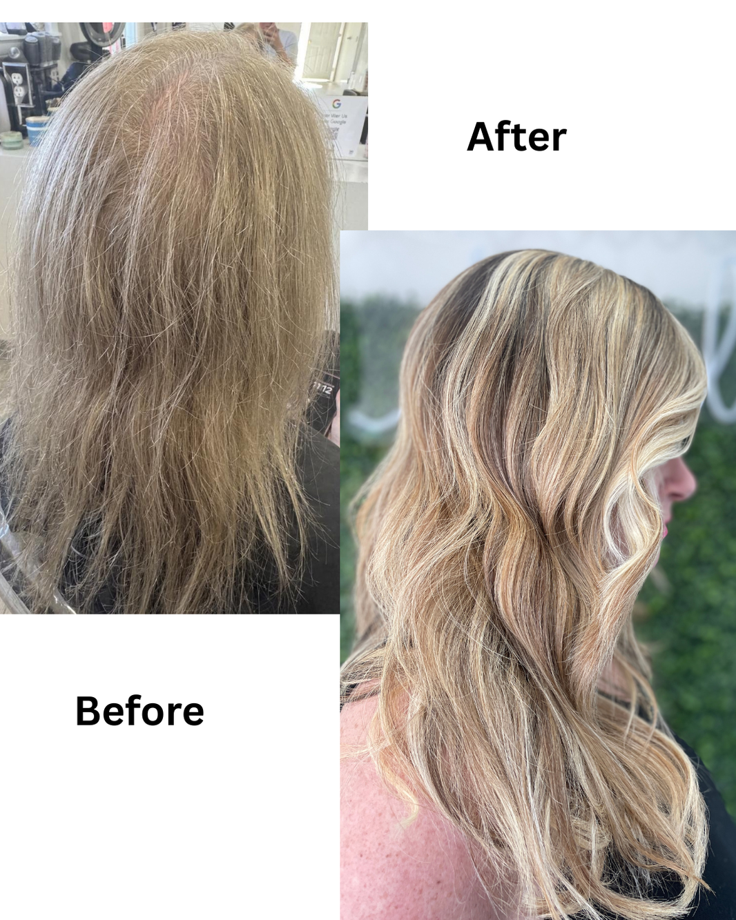 Can hair grow back after hair loss photo