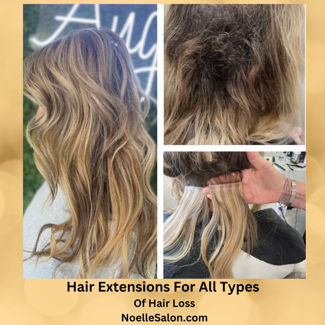 Hair Extensions for Female Pattern Baldness