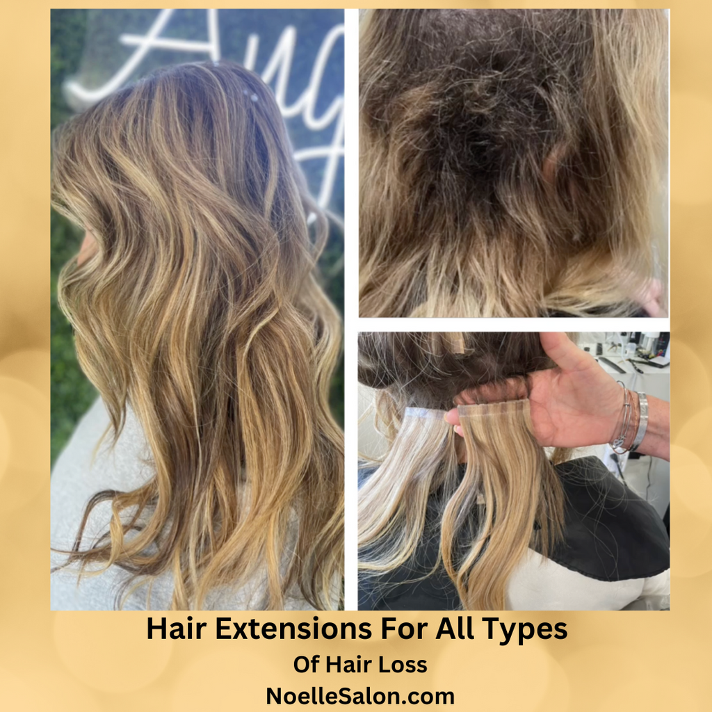Can you wear hair extensions if you have hair loss?