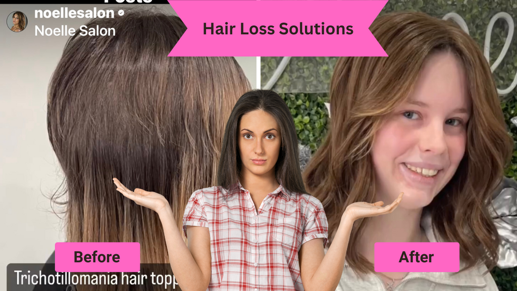 Real Results: Hair Loss Before and After Boston