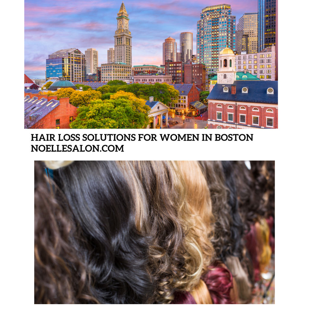 Hair Loss Solution For Women In Boston