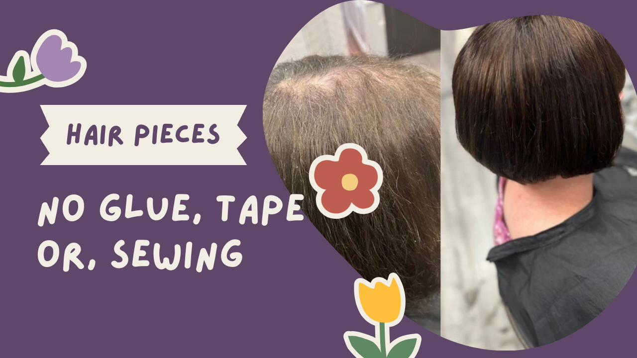 Before and after hair replacement piece in Boston