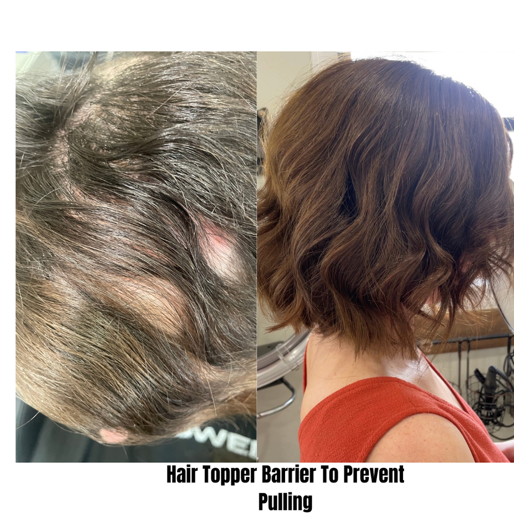 Hair loss prevention - Hair Topper Barrier Prevents Pulling Due To Trichotillomania
