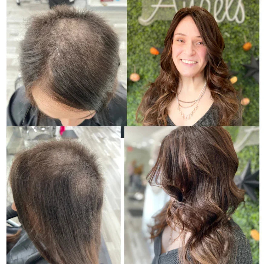 Before and after showing hair topper with bangs for fuller, natural-looking hair.