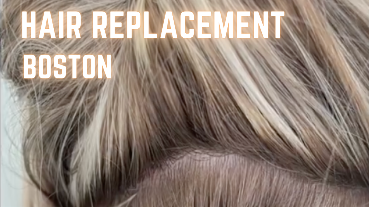 Boston Salon Helps With Alopecia: Solutions for Hair Loss