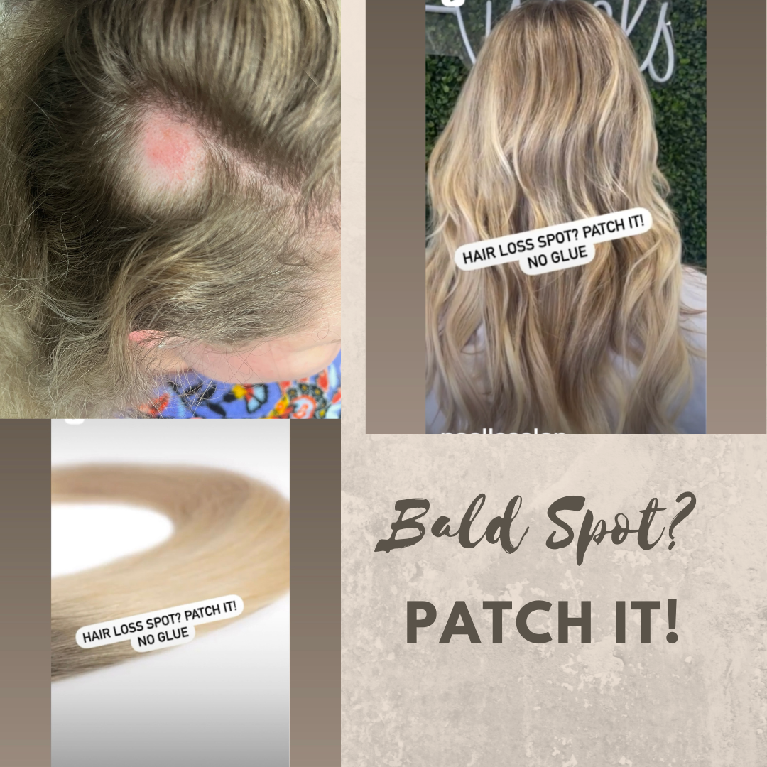 Hair Loss Human Hair Patch For Bald Spots noellesalon
