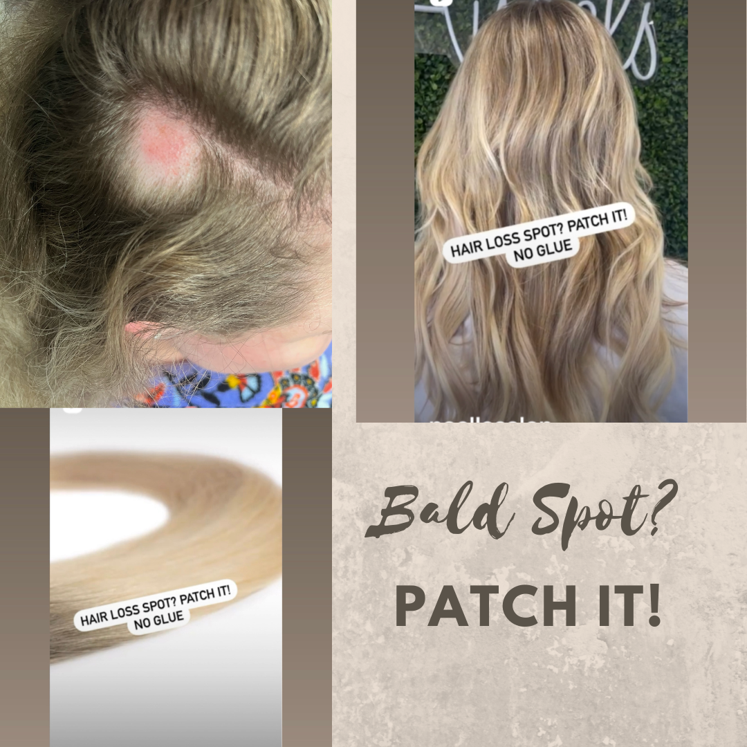 Hair Loss: Human Hair Patch For Bald Spots – noellesalon