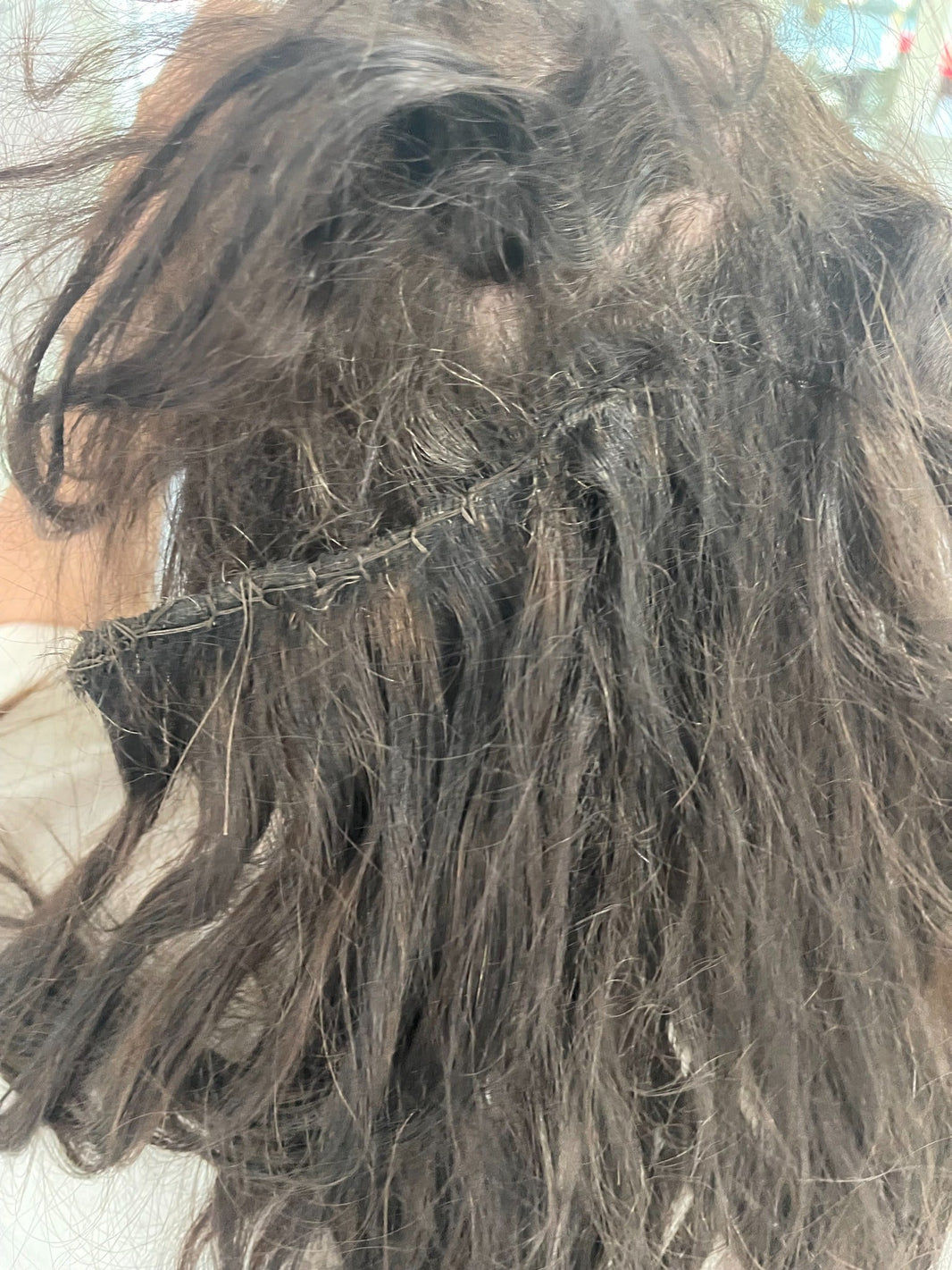 Scalp irritation caused by heavy hair extensions creating excessive tension and discomfort.