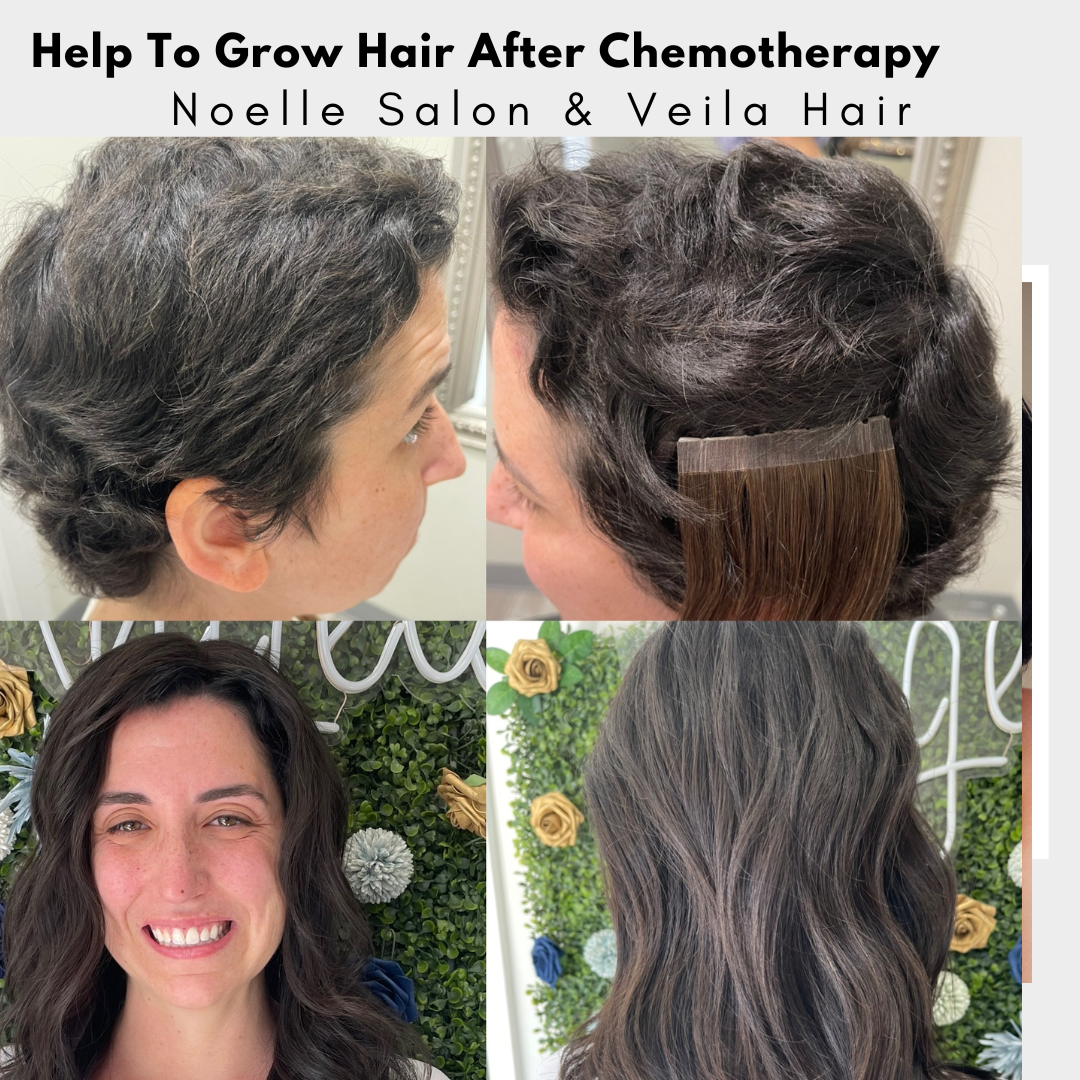 Help To Grow Hair After Chemotherapy noellesalon