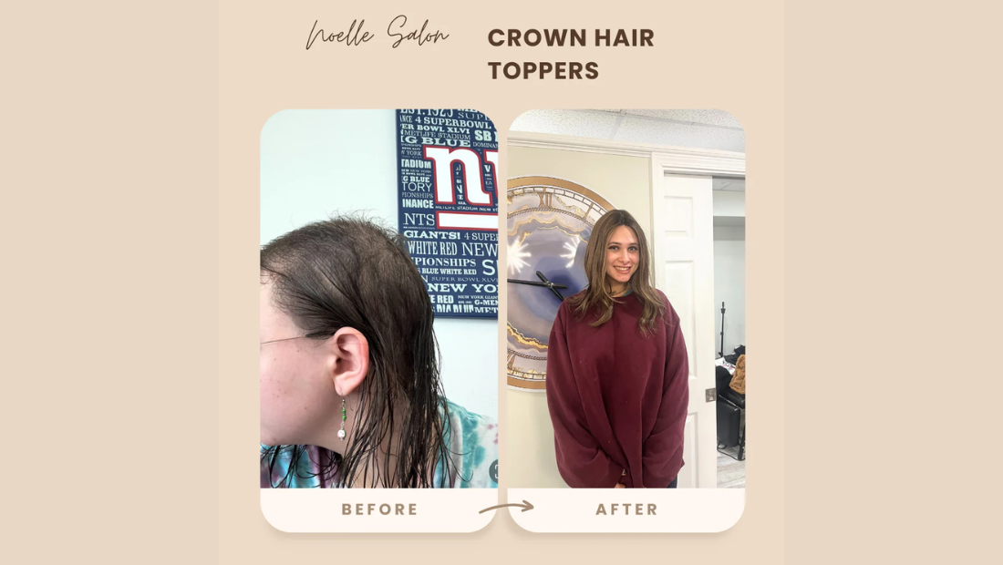 how to wear a wig topper