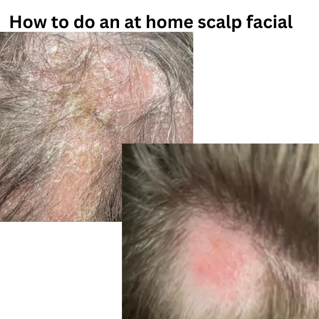 At-Home Scalp Facial for healthier hair and hair loss