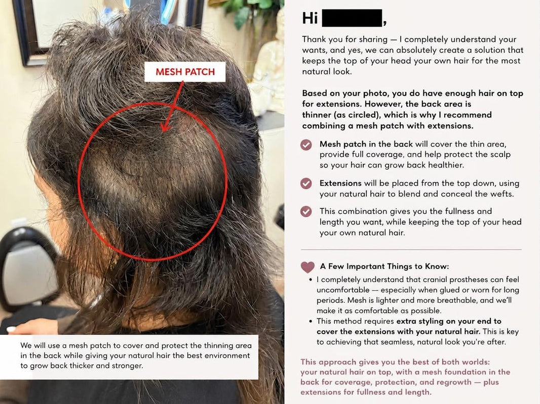 hair loss consultation online 