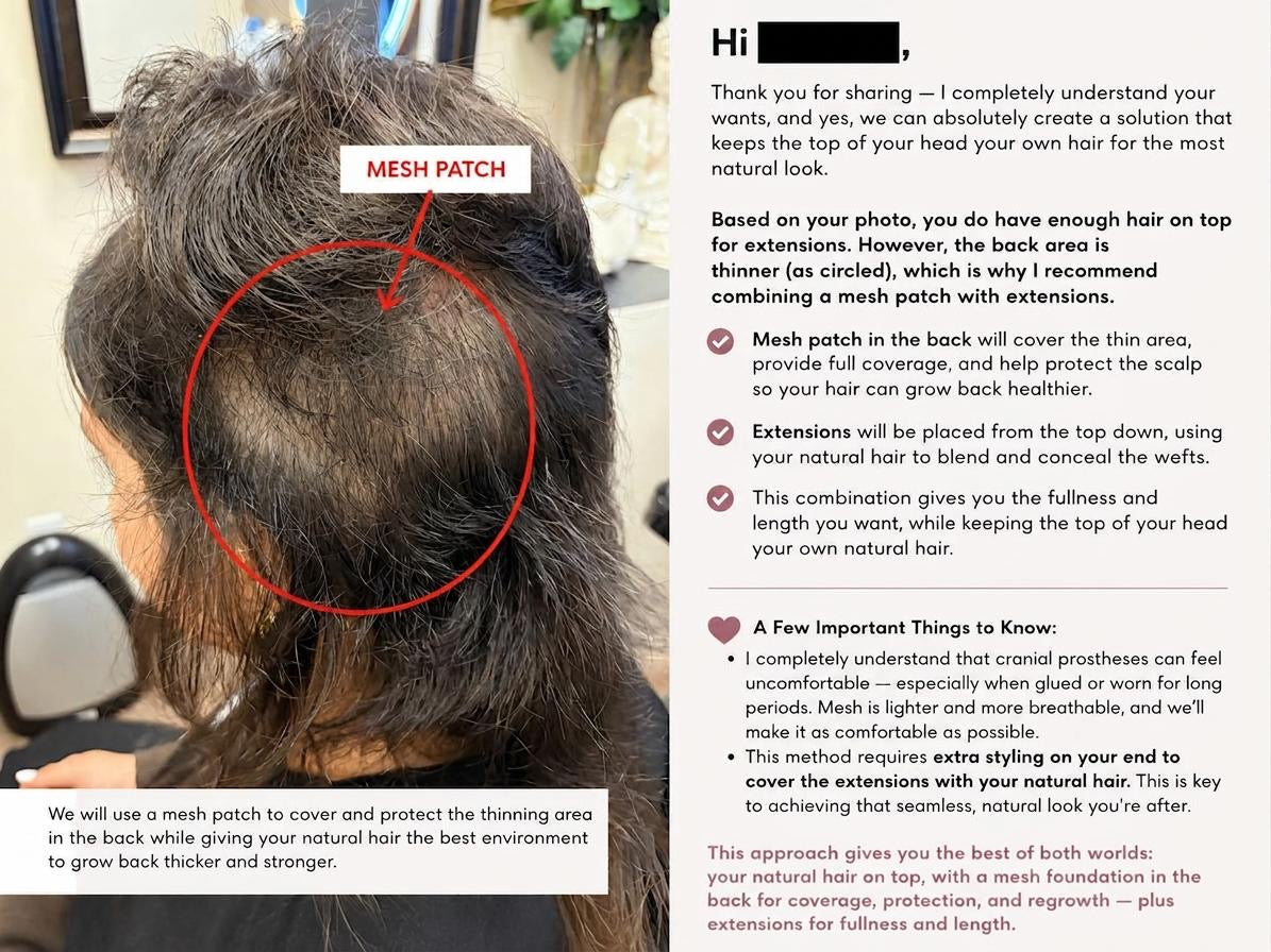 hair loss consultation online 