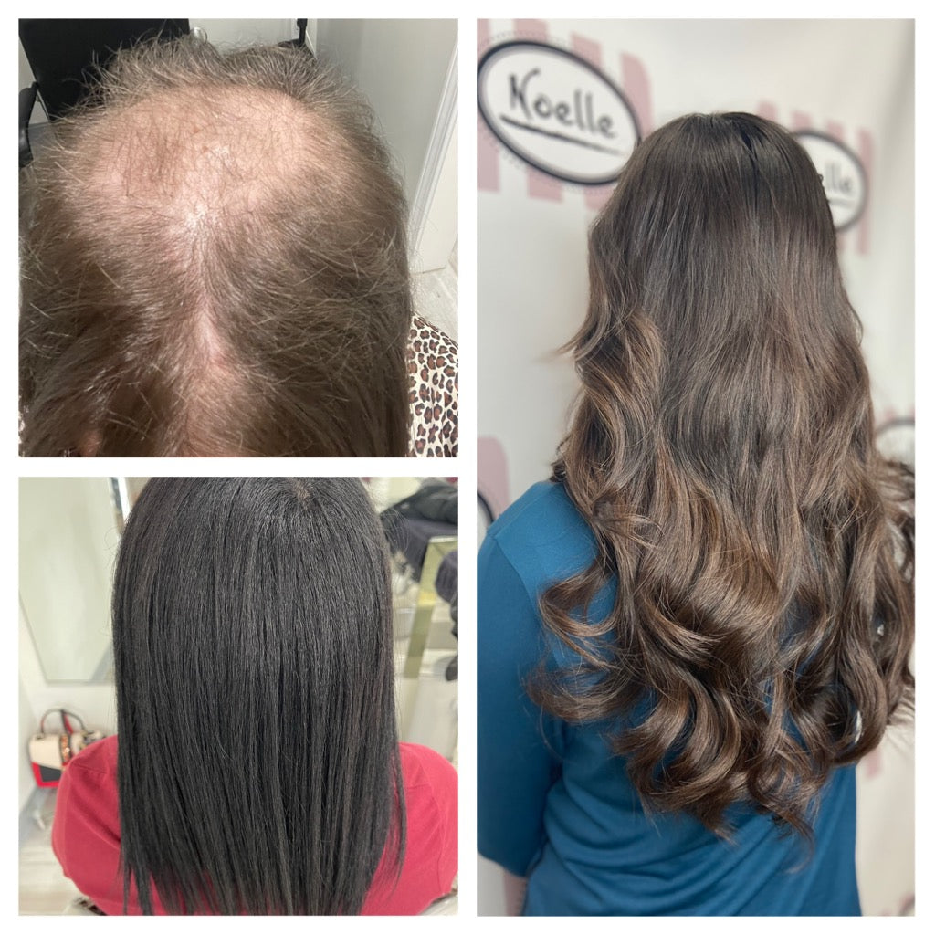 Hair Loss Management Tips