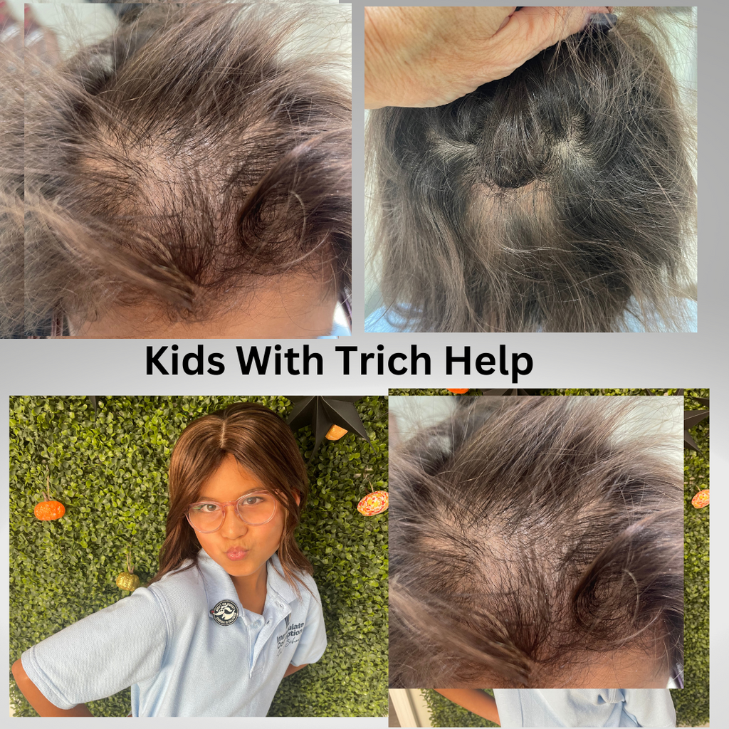 Help for kids with trichotillomania