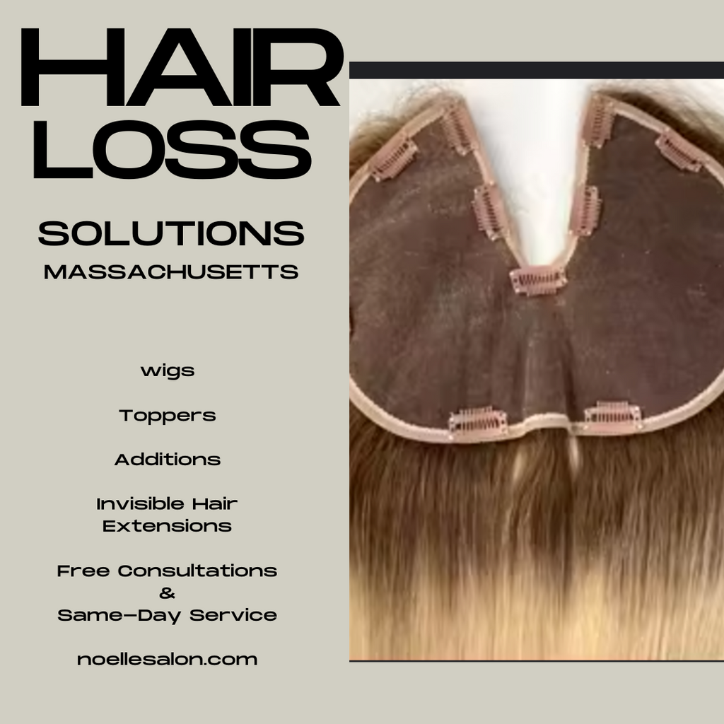 Hair Loss Solutions Massachusetts