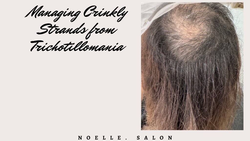 Managing Trichotillomania Crinkly Hair Strands: Helpful Tips