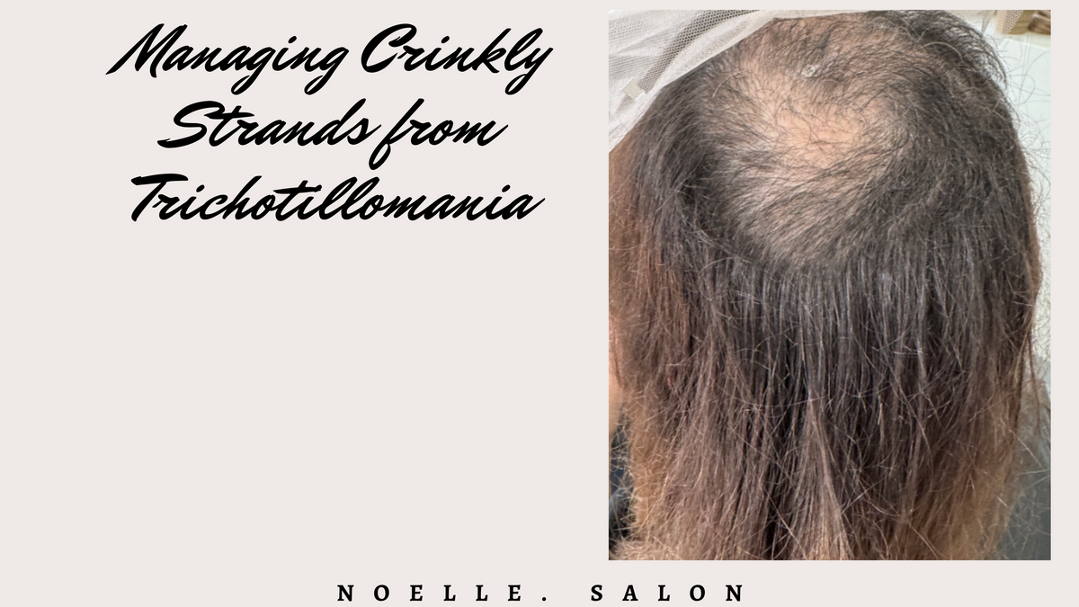 Managing Trichotillomania Crinkly Hair Strands: Helpful Tips – noellesalon